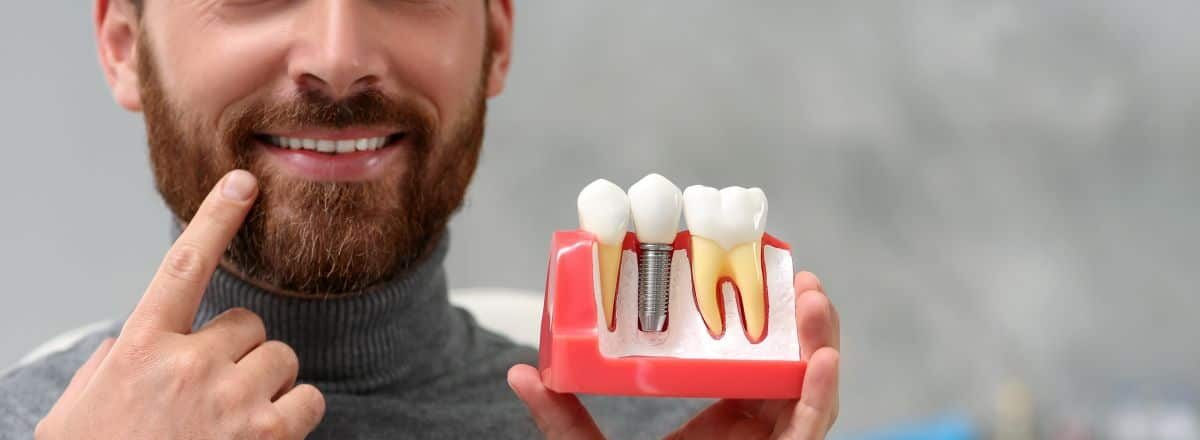 Dental Implants: A Permanent Solution for Missing Teeth at Jason B. Couch DDS